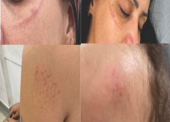 Mãe e filho são agredidos por adolescente com transtorno do espectro autista (TEA) na UPA de Divinópolis