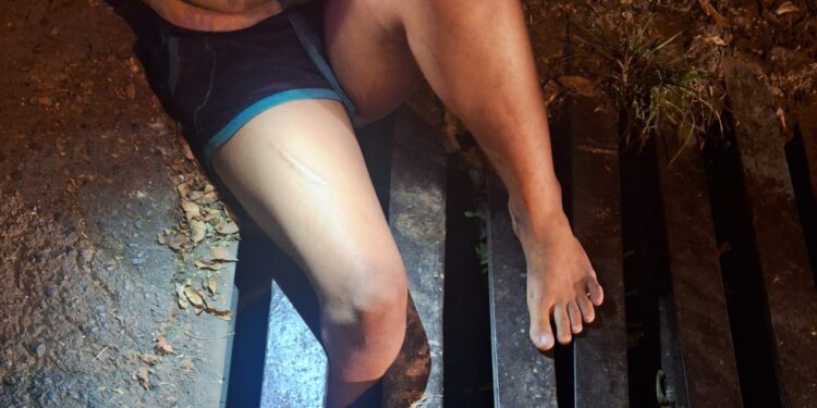 Criança fica ferida após ter a perna presa em grade de bueiro em Arcos