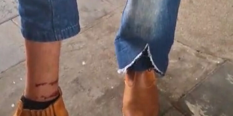 População de Formiga enfrenta aumento de ataques de cães nas ruas