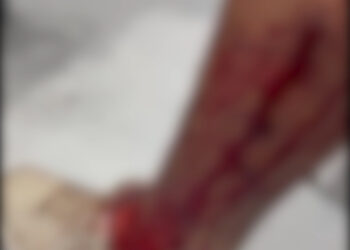 Comerciante da área do Terminal Rodoviário de Formiga é atacado por bando de cães e fica ferido