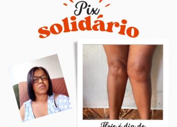 Moradora de Córrego Fundo luta contra dores no joelho e busca ajuda para cirurgia de artroplastia