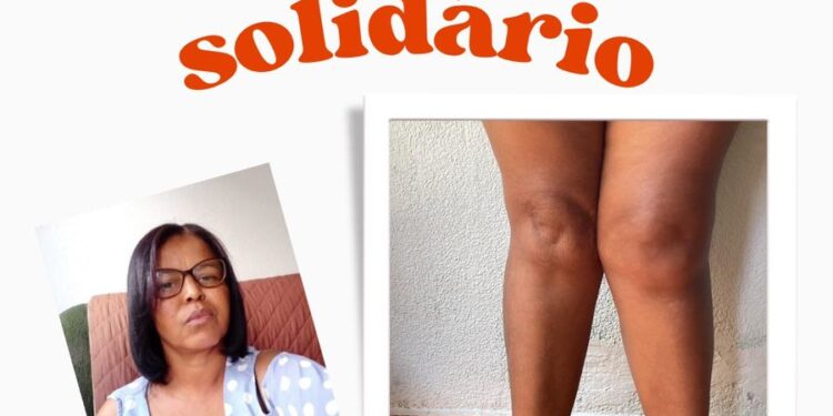 Moradora de Córrego Fundo luta contra dores no joelho e busca ajuda para cirurgia de artroplastia