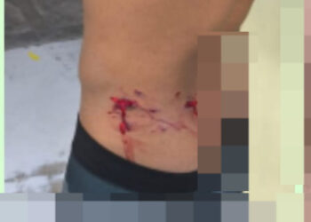 Jovem é preso por agredir ex-companheira em Formiga; atual namorado também ficou ferido