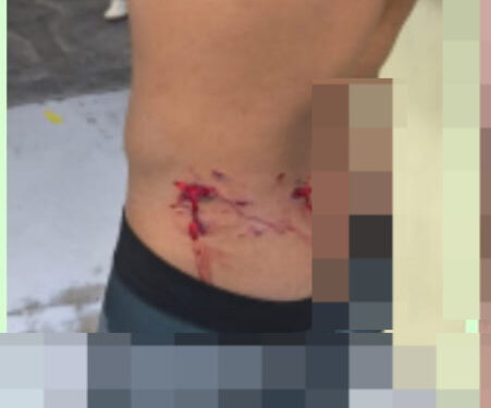 Jovem é preso por agredir ex-companheira em Formiga; atual namorado também ficou ferido
