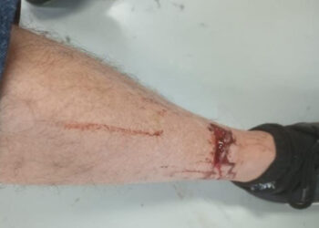 Formiga registra 180 atendimentos na UPA por “acidentes antirrábicos” no primeiro  quadrimestre de 2025