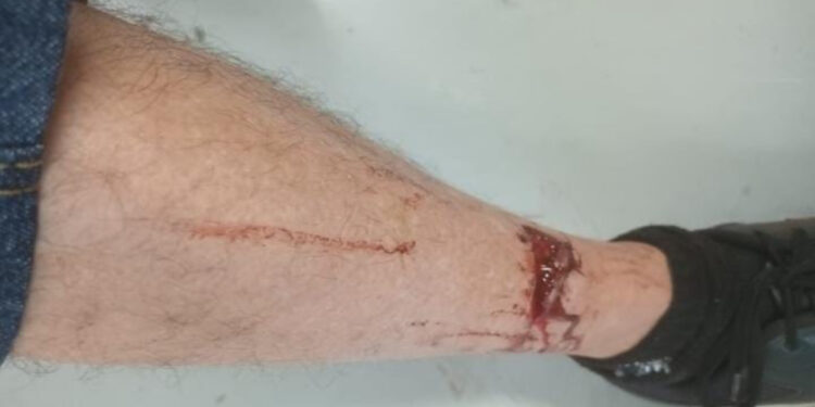 Formiga registra 180 atendimentos na UPA por “acidentes antirrábicos” no primeiro  quadrimestre de 2025