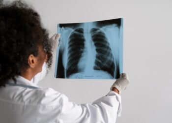 “Estamos enfrentando um surto”, declara governador Zema sobre aumento de doenças respiratórias em Minas Gerais