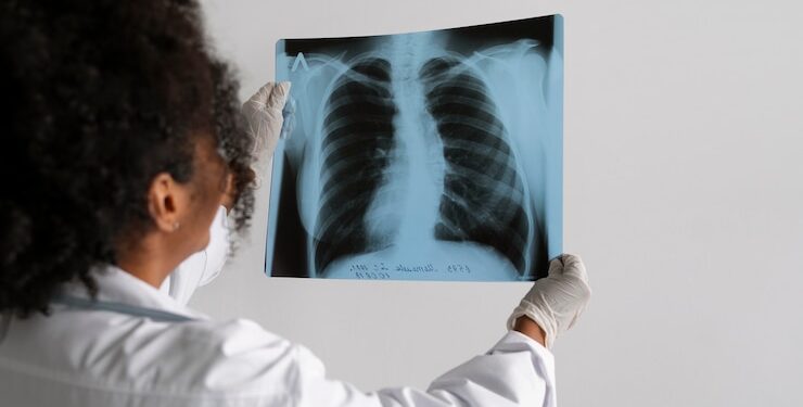 “Estamos enfrentando um surto”, declara governador Zema sobre aumento de doenças respiratórias em Minas Gerais