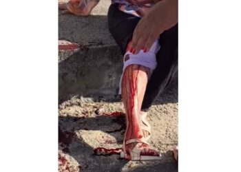 Mulher fica ferida após ataque de cachorro no bairro Mangabeiras, em Formiga