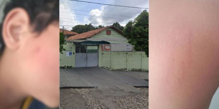 Menino de 11 anos é agredido a pauladas em escola de Divinópolis; mãe acusa diretoria por ‘normalizar situação’