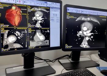 Centro de Imagem da Santa Casa amplia portfólio de exames com novo procedimento de Angiotomografia de Coronárias