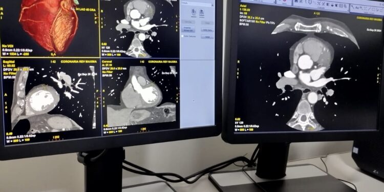 Centro de Imagem da Santa Casa amplia portfólio de exames com novo procedimento de Angiotomografia de Coronárias