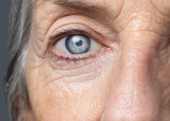 Cirurgia de Catarata sem Espera: Mais Saúde facilita acesso ao melhor da oftalmologia