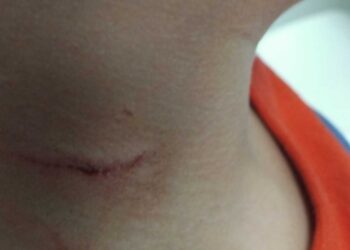 Criança tem pescoço cortado por homem em ataque repentino no Centro de Divinópolis