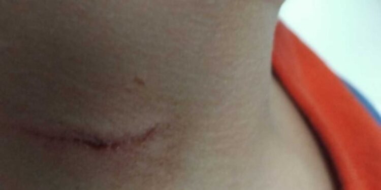 Criança tem pescoço cortado por homem em ataque repentino no Centro de Divinópolis