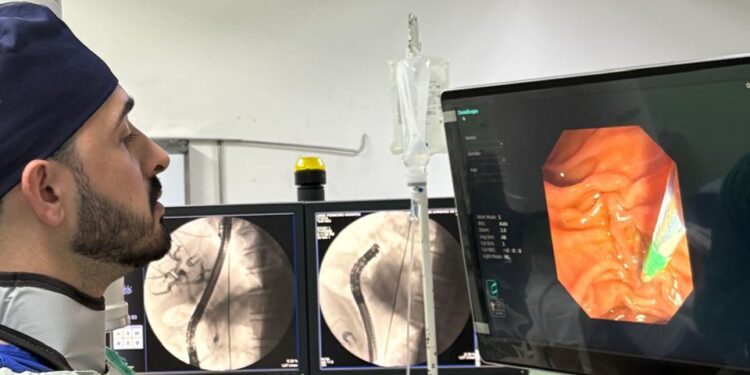 Santa Casa realiza procedimento inovador de endoscopia