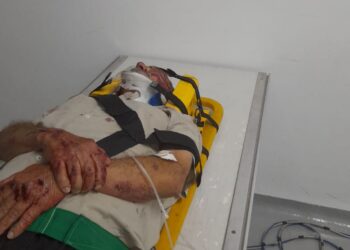 Família divulga estado de saúde de idoso atropelado no bairro Alvorada