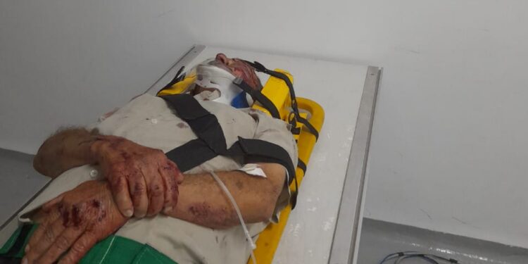 Família divulga estado de saúde de idoso atropelado no bairro Alvorada