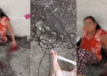 Idosa ferida por fios soltos em Divinópolis não teve dedos reimplantados, diz filho