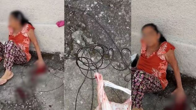 Idosa ferida por fios soltos em Divinópolis não teve dedos reimplantados, diz filho