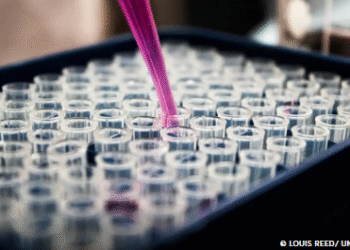 Pesquisas brasileiras avançam no diagnóstico de Alzheimer