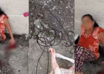 Idosa tem pontas dos dedos decepados por fios pendurados em Divinópolis