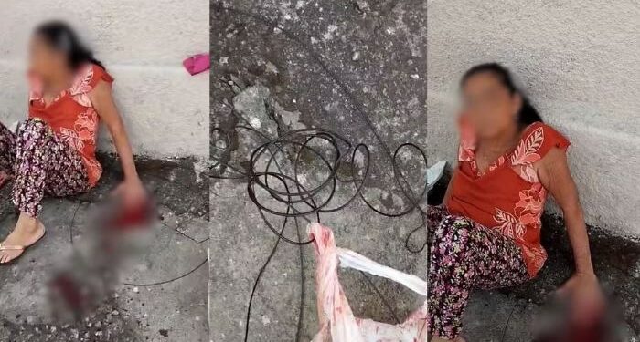 Idosa tem pontas dos dedos decepados por fios pendurados em Divinópolis