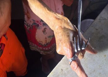 Mulher procura bombeiros após anel e garfo ficarem presos ao dedo durante tarefas domésticas em Formiga