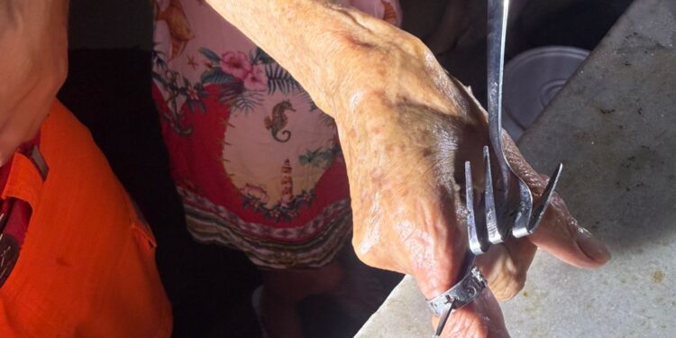Mulher procura bombeiros após anel e garfo ficarem presos ao dedo durante tarefas domésticas em Formiga