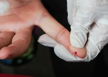 SUS passa a oferecer teste rápido de dengue