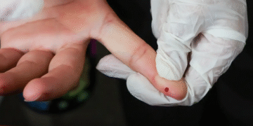 SUS passa a oferecer teste rápido de dengue