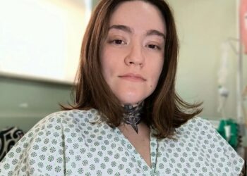 Jovem com ‘a pior dor do mundo’ retoma faculdade de medicina veterinária em Bambuí