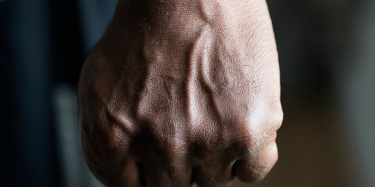 Homem é agredido por irmã e cunhado com madeira, picareta e pá após disputa por herança, em Arcos