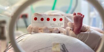 Minas Gerais é o primeiro estado do país a rastrear gratuitamente 64 doenças no Teste do Pezinho 