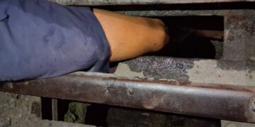 Criança fica com perna presa em bueiro e é resgatada pelos bombeiros, em Arcos